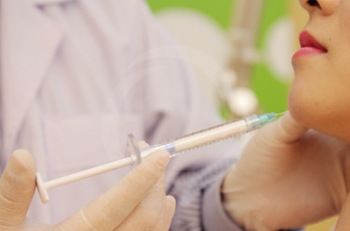 Độn cằm không phẫu thuật giá bao nhiêu tiền?