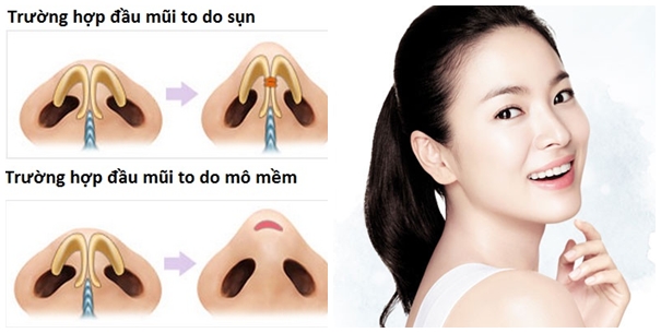 do-dac-do-an-toan-thu-nho-dau-mui-noi-soi-tai-kangnam2